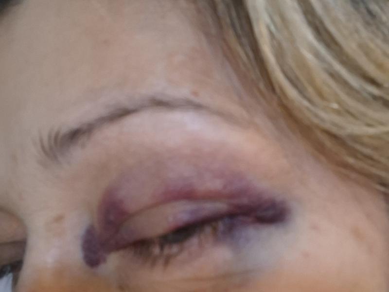 Συγκλονίζει η Ελένη Βεργή η γυμνάστρια που τραυματίστηκε προσπαθώντας να προστατεύσει τους μαθητές της!