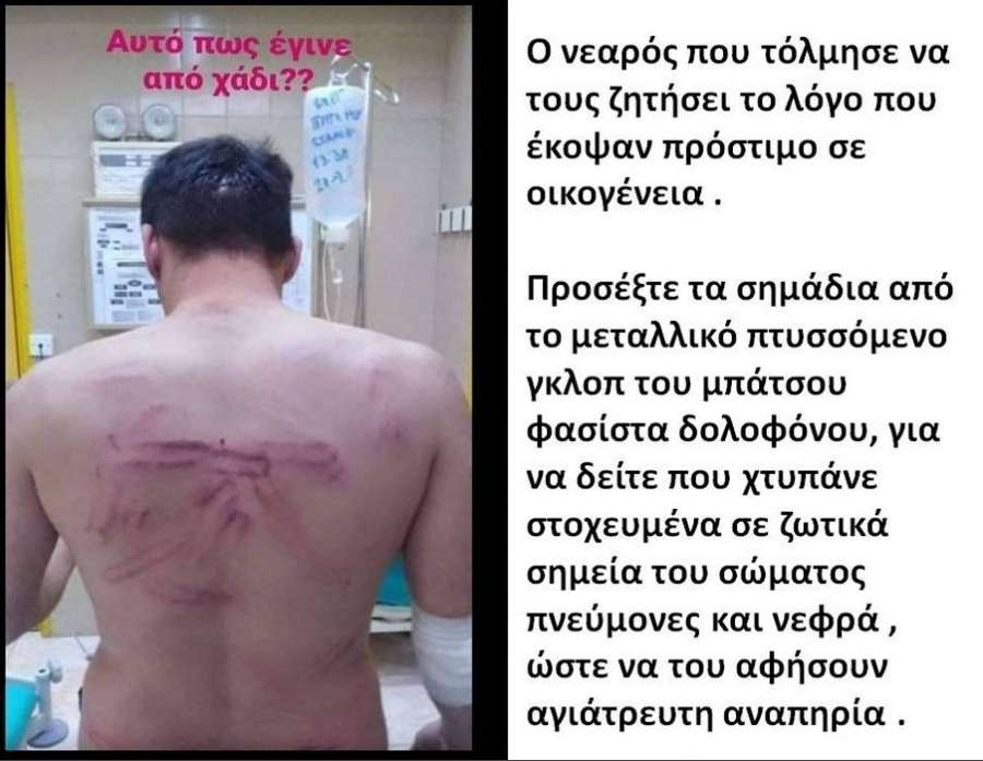 Το θύμα της αστυνομικής βίας: «Με χτυπούσαν από τα πόδια ως το κεφάλι» - ΒΙΝΤΕΟ