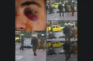 «Αναίσθητος, πεταμένος μέσα στα αίματα μου, χτυπημένος με πυροσβεστήρα» στο συλλαλητήριο κατά της πανεπιστημιακής αστυνομίας