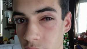 Ξυλοκόπησαν 16χρονο μαθητή στη Χαλκιδική και τον «έστειλαν» στο Νοσοκομείο –  Η συγκλονιστική ανάρτηση της μητέρας