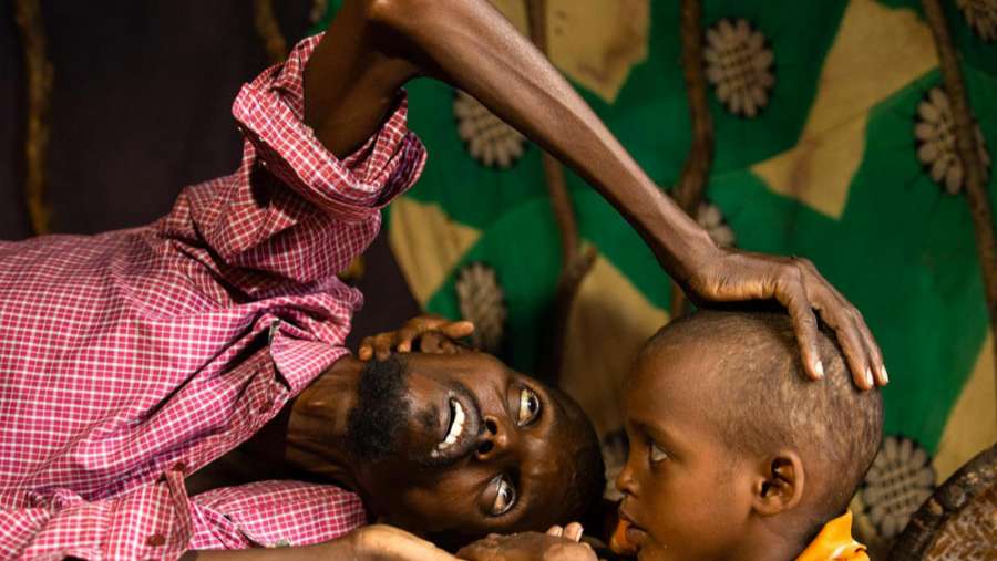 7 εκατομμύρια άνθρωποι κινδυνεύουν να λιμοκτονήσουν στη Σομαλία!