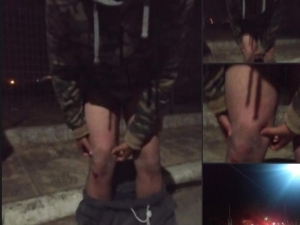 Άγριος ξυλοδαρμός 22χρονου ΑμεΑ στον Πύργο από αστυνομικούς επειδή τον πέρασαν για διαρρήκτη